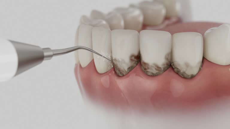 Reliable Emergency Dentist contractor in Hurlock, MD by Smile Center Dentistry